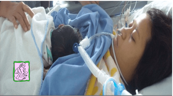 Rumah Sakit Sayang Bayi Untuk Mendukung Busui dengan Komplikasi Medis