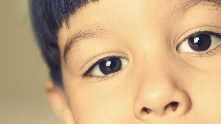 Mata Sipit Merupakan Gejala Penyakit Pada Anak?