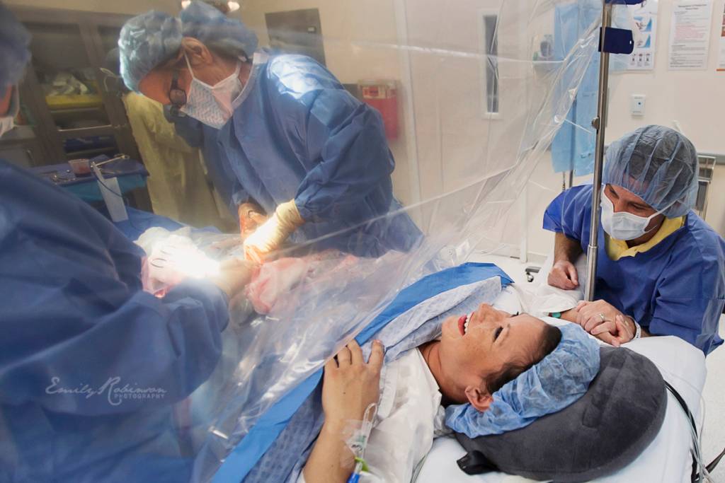 Gentle C-Section, Pengalaman Melahirkan dengan Operasi Cesar “Rasa Normal”