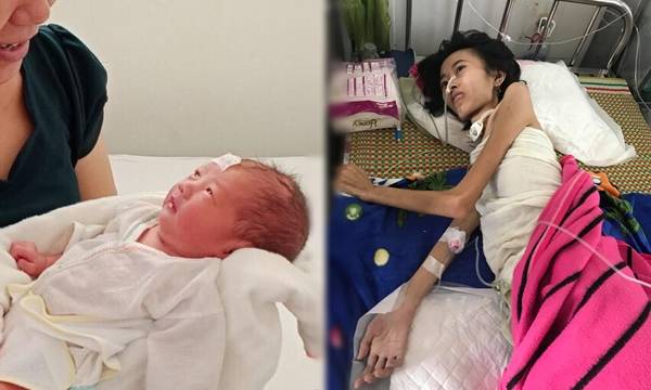 Ibu dengan Bobot Badan 20 kg, Berhasil Melahirkan Bayi Sehat