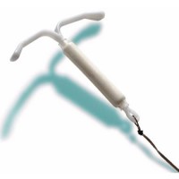 Mungkinkah Saya Hamil? Padahal Saya Sudah Pakai IUD!