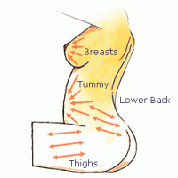 Tips untuk Mencegah Timbulnya Stretch Marks