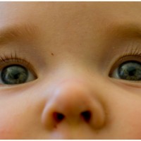 Strabismus atau Mata Juling pada Anak