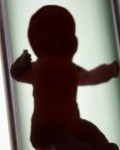 Sukses dengan Program Bayi Tabung