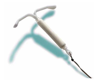 Bahayakah IUD Yang Telat Dilepas?