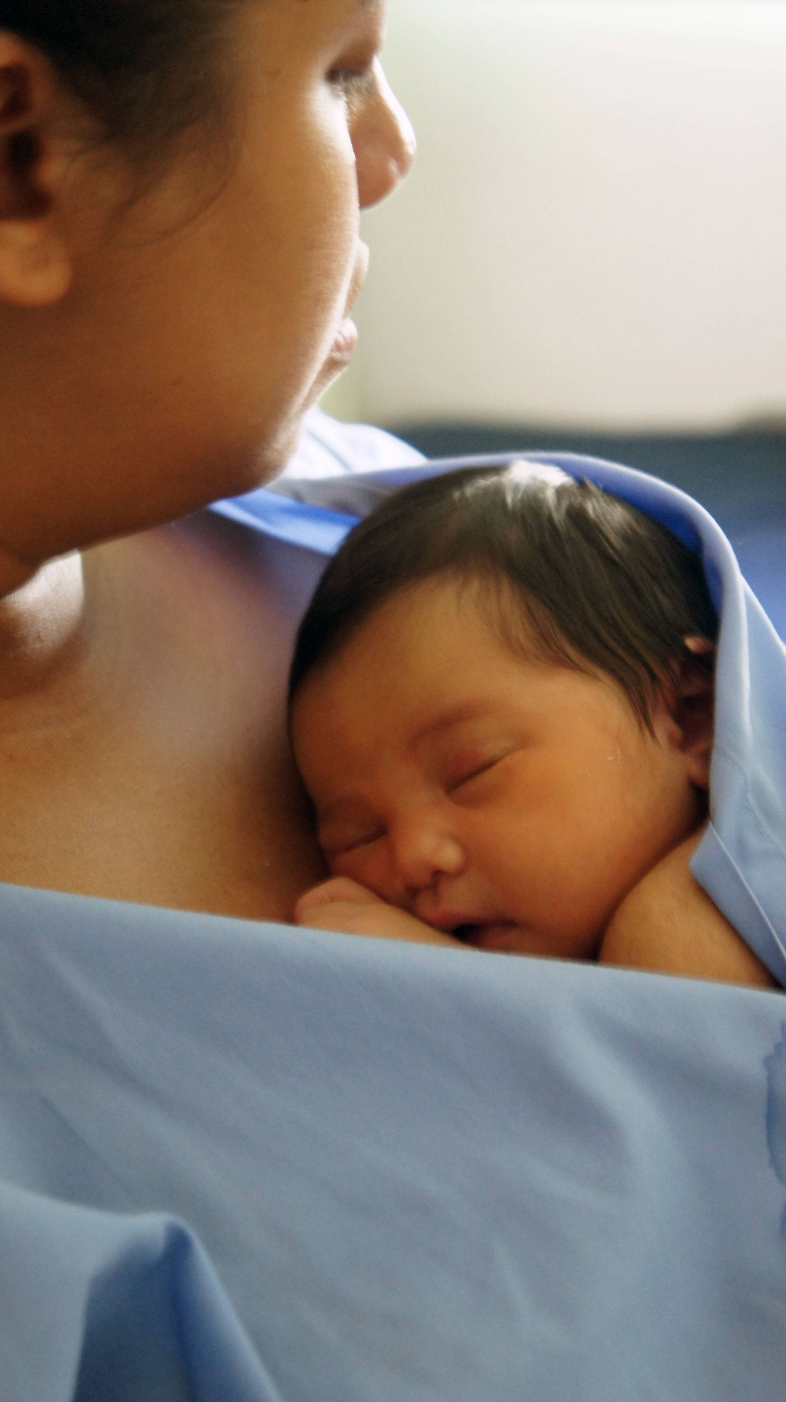 Breastfeeding Jaundice