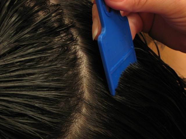 Memerangi Kutu Rambut