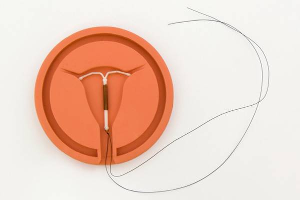 Hamil Dengan IUD, Amankah?