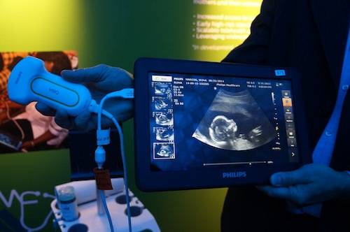 Philips Menyelamatkan Calon Ibu dengan Teknologi