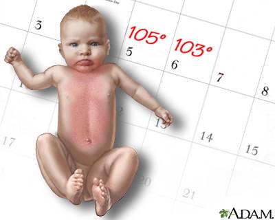 Fever and Rash
