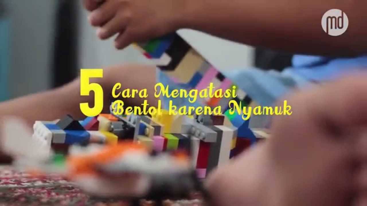 5 Cara Mengatasi Bentol Karena Nyamuk
