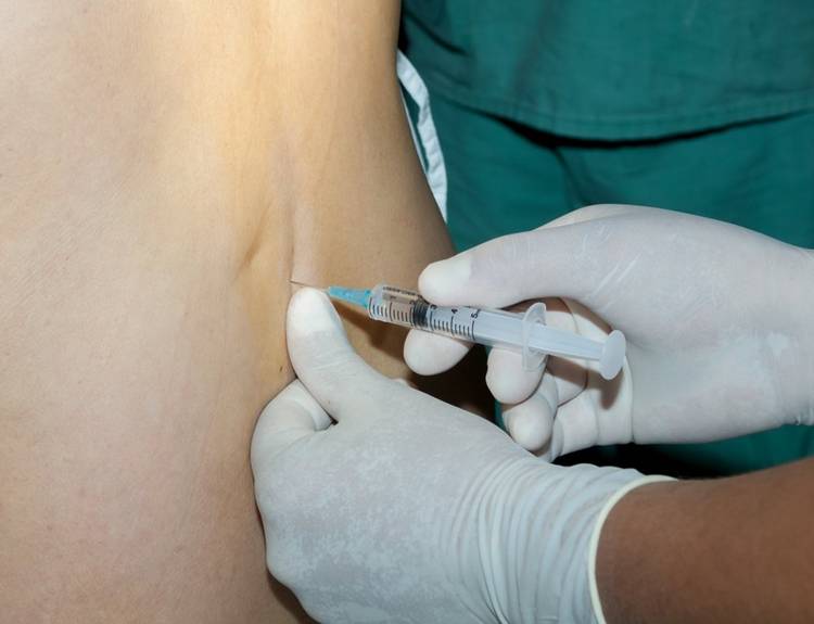 Plus Minus Pemakaian Epidural