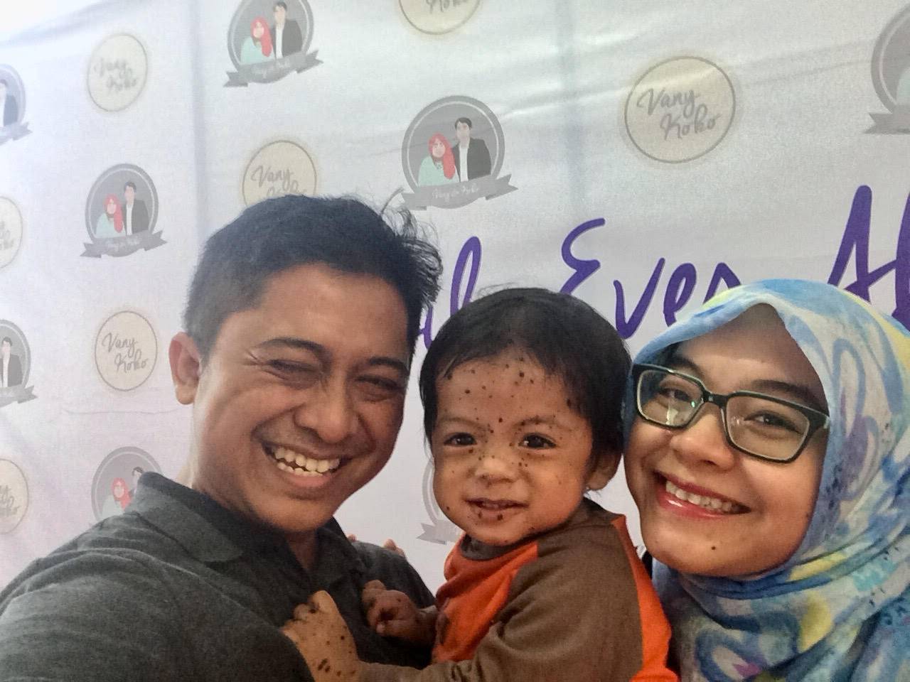 Anakku Terlahir dengan Giant Congenital Melanocytic Nevus