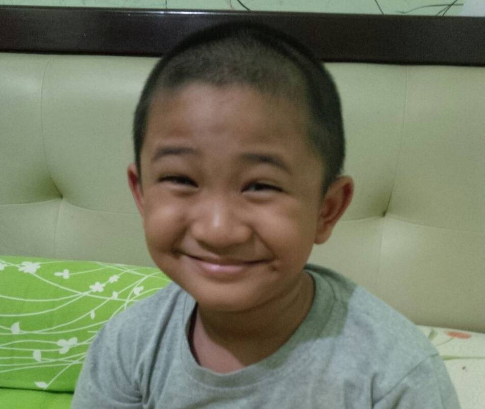 Bengkak di Kaki Anak Kami yang Berujung Rhabdomyosarcoma