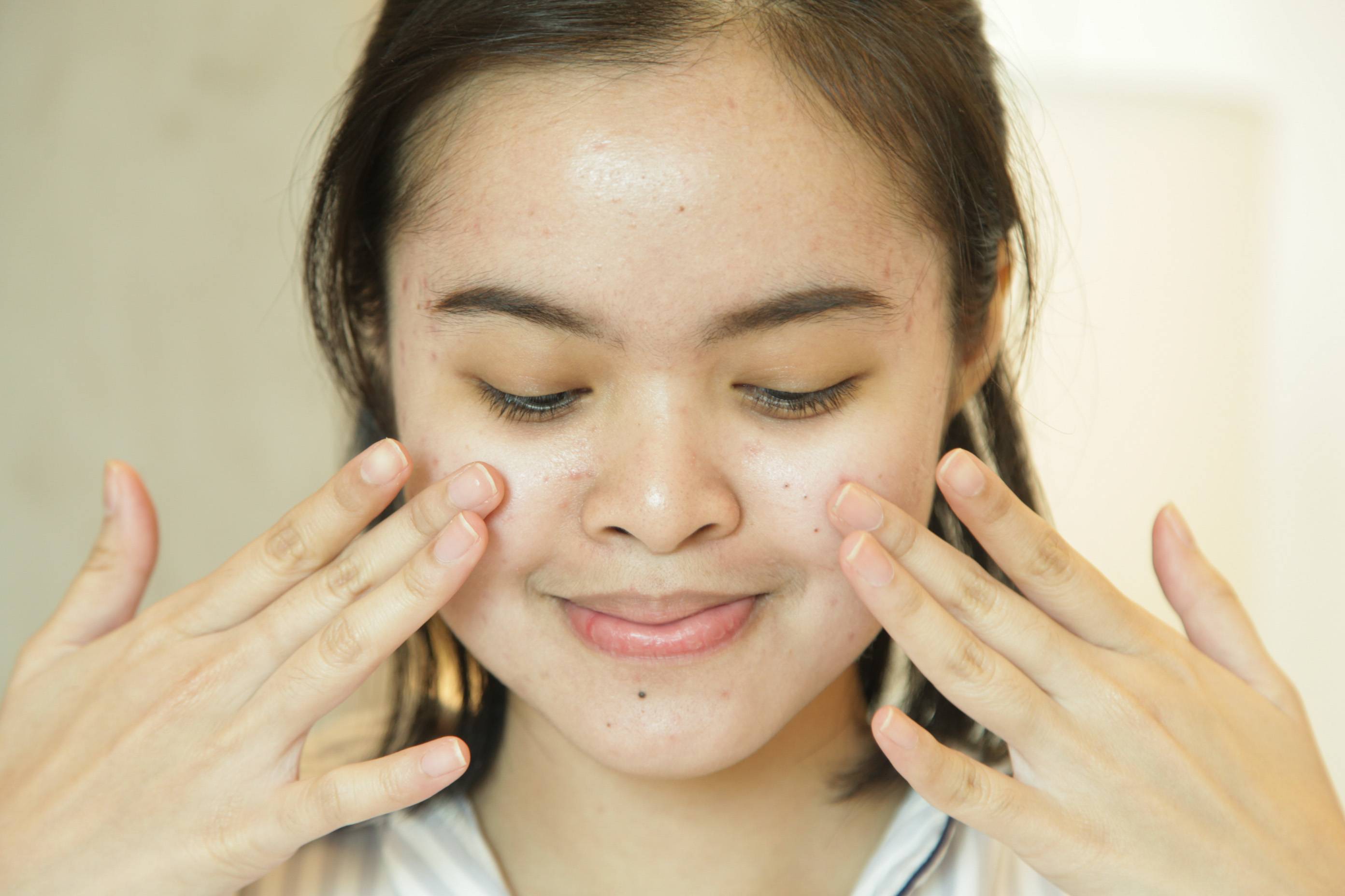 Skin Care 101: Get The Glowing Skin