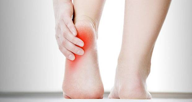 Terasa Nyeri di Telapak Kaki Belum Tentu Asam Urat, Bisa Jadi Plantar Fasciitis