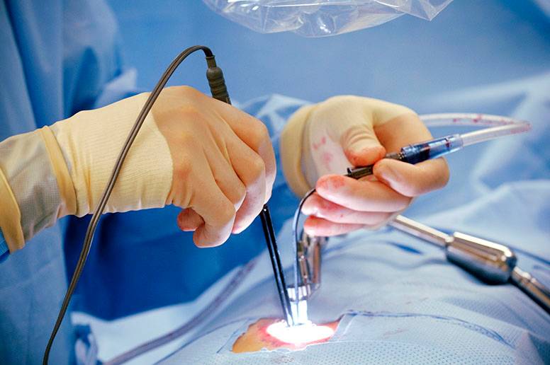 Minimal Invasive, Ketika Tindakan Operasi Jauh dari Kata Menyeramkan