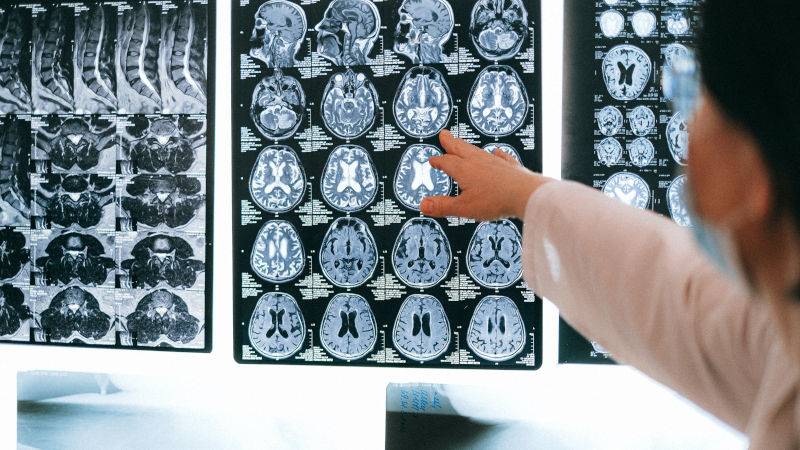 3 Hal Penting tentang Mengasuh Anak Cerebral Palsy