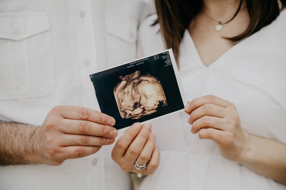 Memahami Metode Surrogate Mother atau Ibu Pengganti, Cara Alternatif Mempunyai Anak