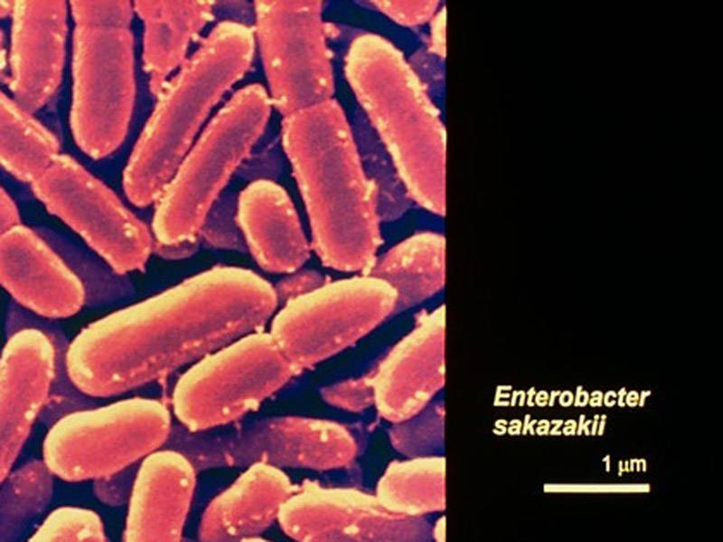 Mengenal Bakteri Sakazakii