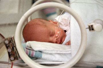 Wajib Tahu, Fakta Lengkap Tentang Kesehatan Ibu dan Anak Kelahiran Prematur