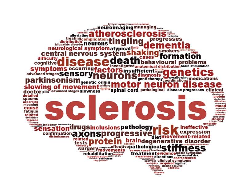 Multiple Sclerosis, Bisakah Dicegah?