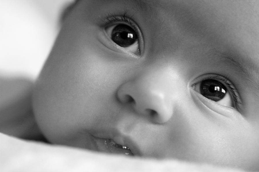 Cara Mengobati Mata Bayi yang Belekan