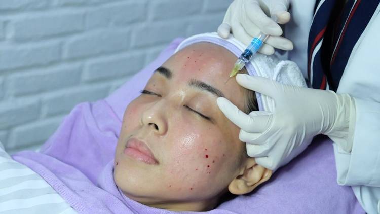 Skin Booster Untuk Wajah Cerah di Hari Lebaran