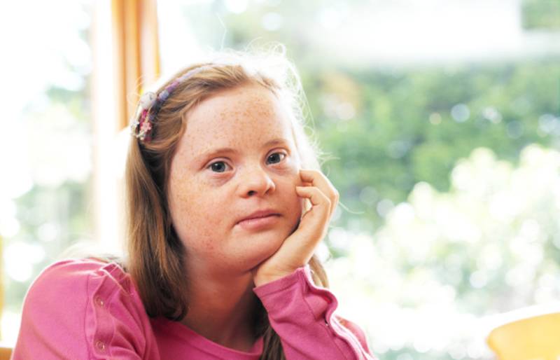 Covid-19 Sepuluh Kali Lebih Berisiko Mematikan pada Down Syndrome