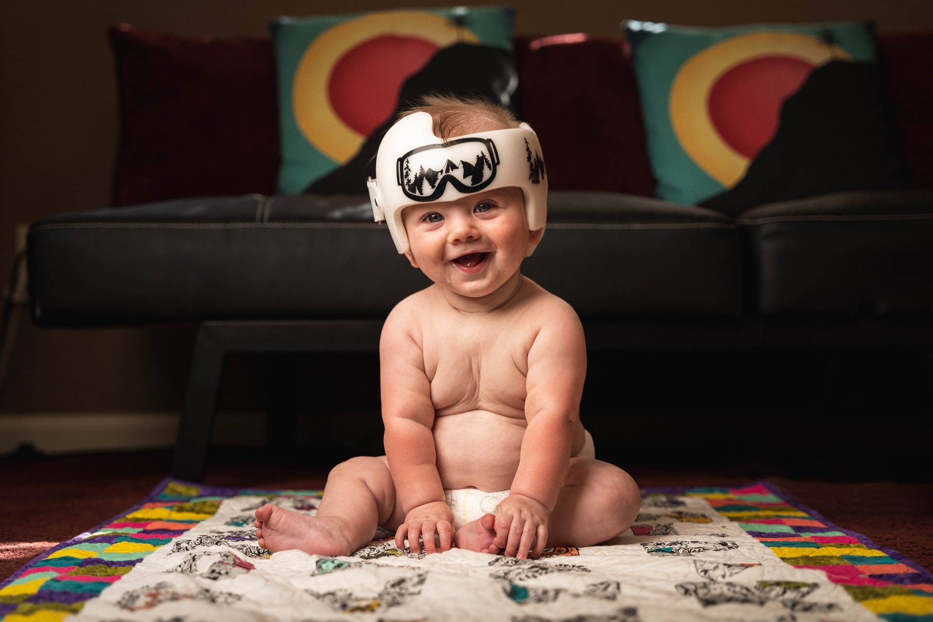 Craniosynostosis: Ubun-ubun Bayi Tertutup Ketika Baru Lahir